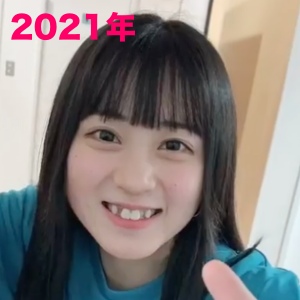 2021年、中川心さんが歯科矯正をする前の画像