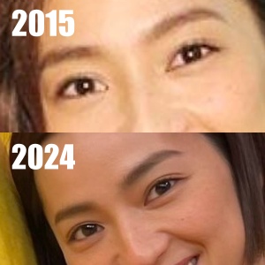 2015年と2024年の、中村アンの目を比べた画像