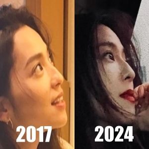 2017年と2024年の、中村アンの鼻を比べた画像