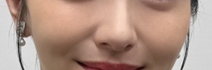 2025年の、整形した疑惑がある浜辺美波の鼻の画像